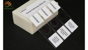 لیبل-لام-پاتولوژی-چیست؟