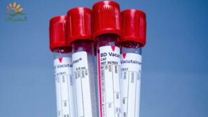 مشخصات-لیبل-آزمایشگاه