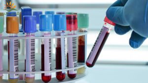 انواع برچسب آزمایشگاهی