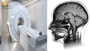 لیبل رادیولوژی و MRI چیست؟